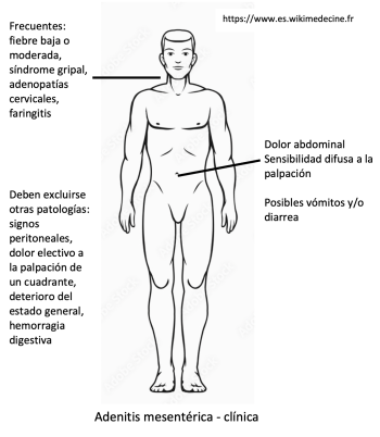 Adenitis mesentérica - síntomas clínicos