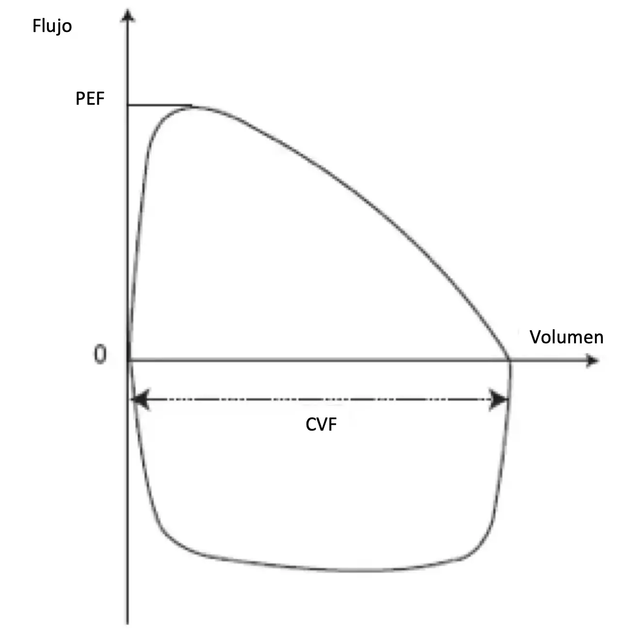 Curva flujo-volumen. La espiración está representada por la curva superior, la inspiración por la curva inferior. CVF = capacidad vital forzada, FEM = flujo espiratorio máximo.